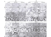 锦波生物获得发明专利授权：“重组III型人源化胶原蛋白在卵巢癌治疗中的用途”