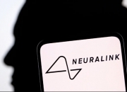 南开大学团队成功完成介入式脑机接口传感器血管内取出试验