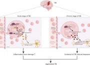脑深部电刺激有助改善脑损伤后的手臂和手部功能