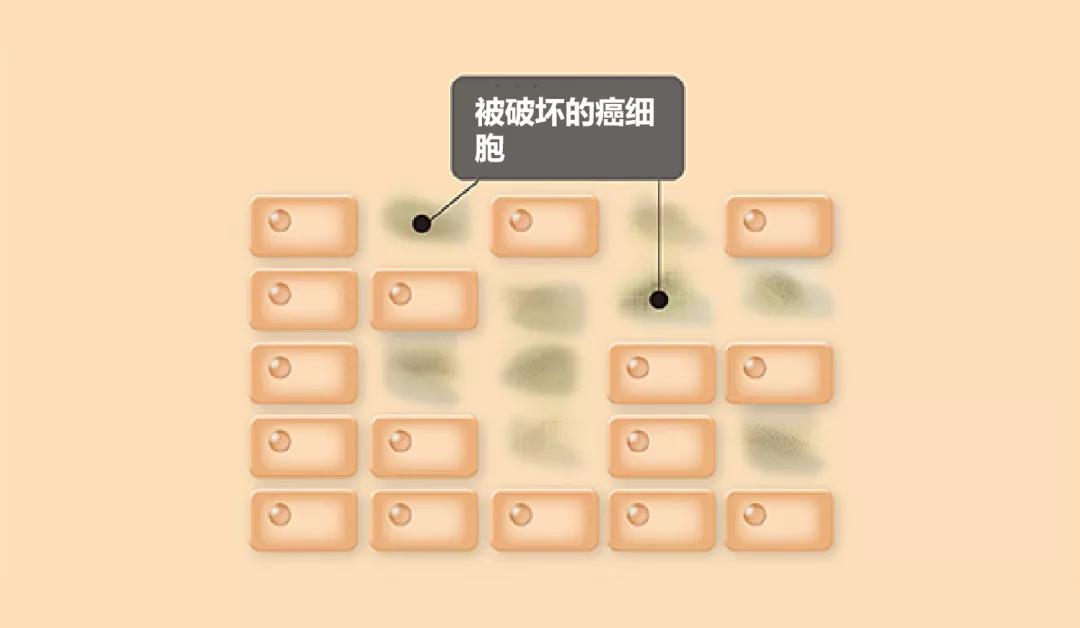 液体胶水成分有望提升硼中子俘获疗法治癌的适用范围